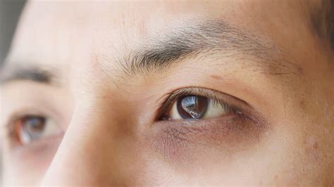 Hormonal Imbalance Skin Issues: Signs You Shouldn’t Ignore