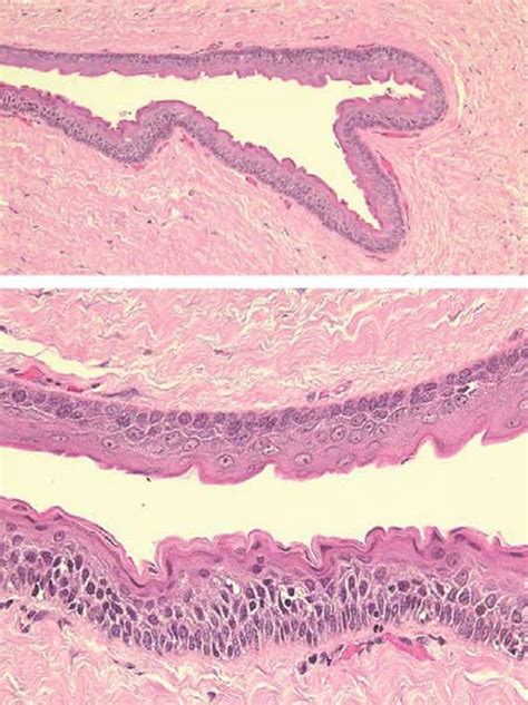 Academy of Dental Knowledge: Odontogenic Keratocyst