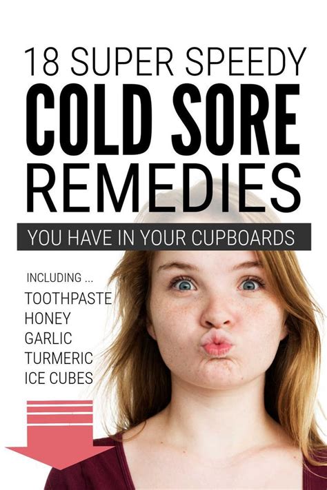 herpes 1 cold sore
