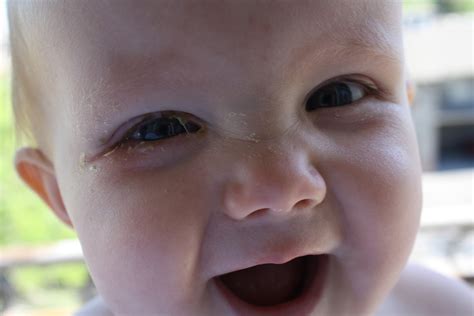 Micah and Rachel: Bye Bye Goopy Eye