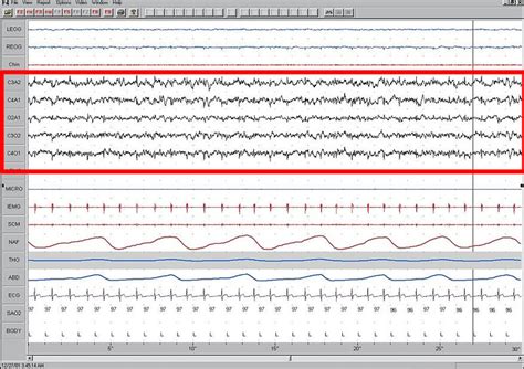 Sleep 的图像结果