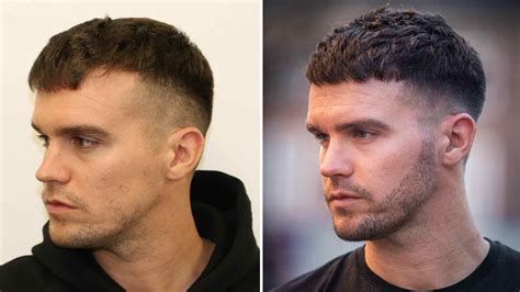 How Much Does a Beard Transplant Cost? Find out at KSL Clinic