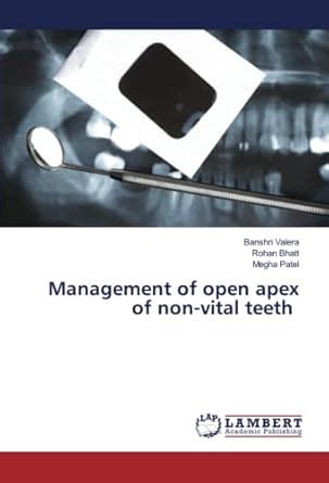Management of open apex of non-vital teeth : Amazon.in: Books