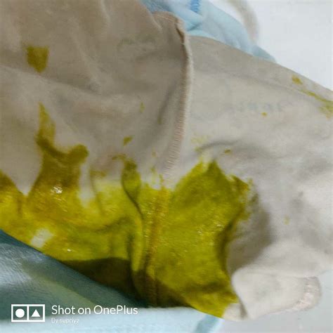 What Does Yellow Diarrhea Mean at Maureen Baker blog