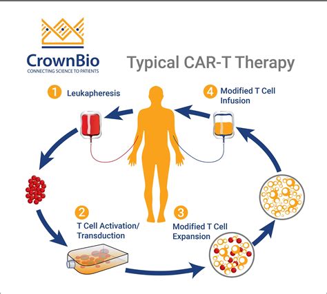 Antigen Escape In Car T-Cell Therapy at Erin Mackenzie blog