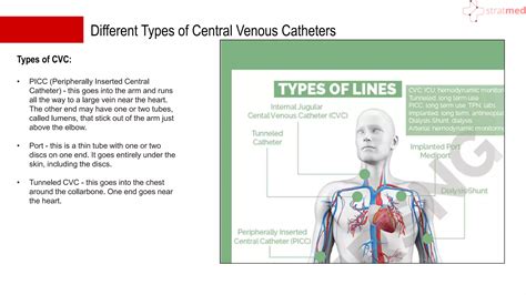 PPT - central line(Central Venous Catheters) | PPTX