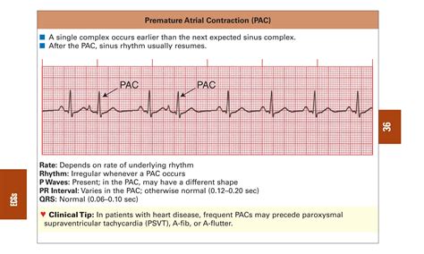 0803613474 - ECG Notes Interpretation And Management Guide.pdf