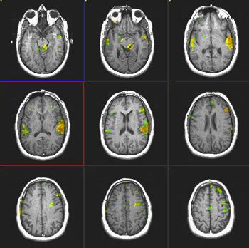 Image result for Language Mapping Scan