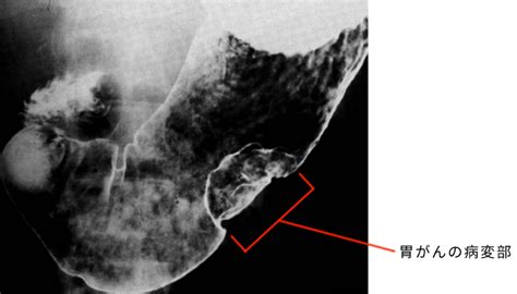 Image result for C. Diff Two-Step Algorithm