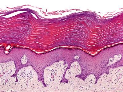 Stratified epithelium — lesson. Science CBSE, Class 9.