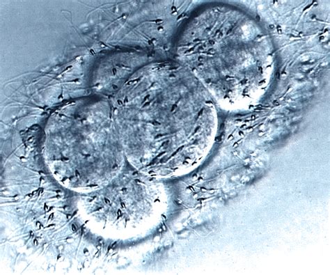 Image result for Vitro Fertilization IVF Process