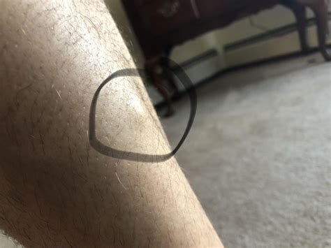 does anyone know why this happens to my leg? when i’m squatting this ...