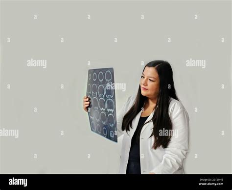 Female neurologist specialist doctor evaluates brain angiography x-ray in radiology for injury ...