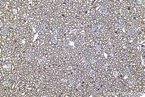 IHCeasy CHMP2A Ready-To-Use IHC Kit KHC1455 | Proteintech