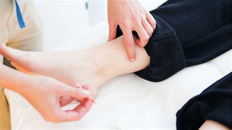 Acupuncture for endometriosis - Be + Well