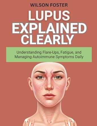 Buy Lupus Explained Clearly: Understanding Flare-Ups, Fatigue, and ...