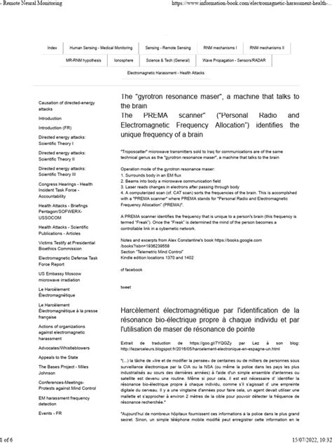 Image result for Calman Remote Neural Monitoring