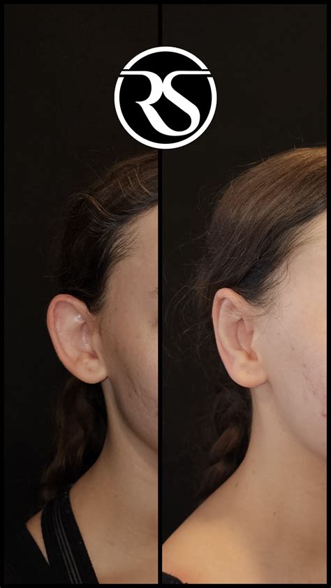 Face | Reshape Plastic Surgery