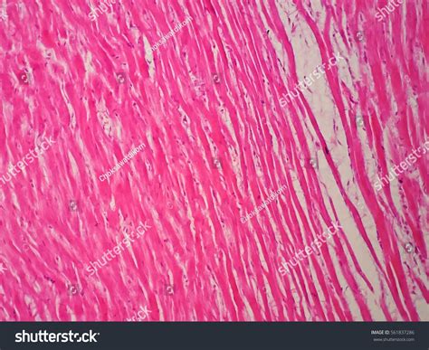 Histology Human Cardiac Muscle Under Microscope Stock Photo 561837286 ...