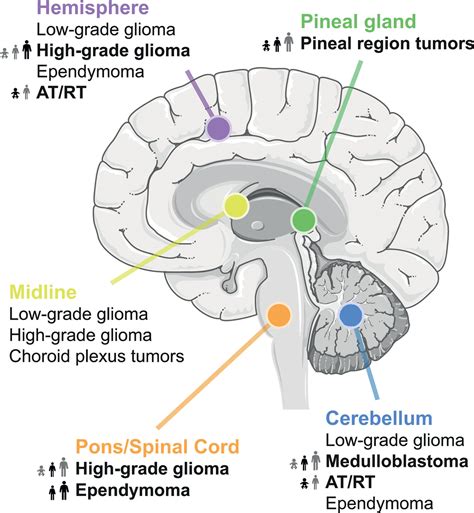 Grades Of Brain Tumors