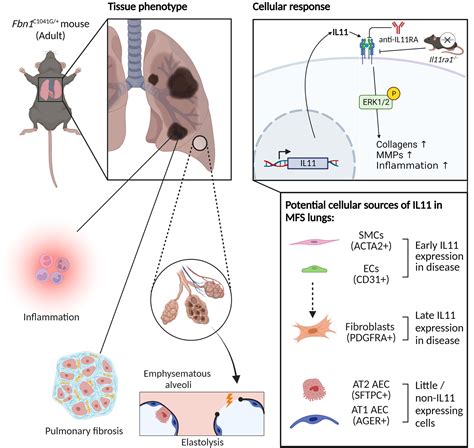 IL11 (Interleukin-11) Causes Emphysematous Lung Disease in a Mouse ...
