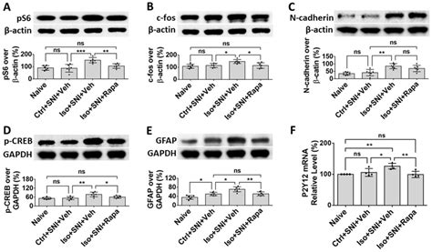 Effects of Early Exposure to Isoflurane on Susceptibility to Chronic ...