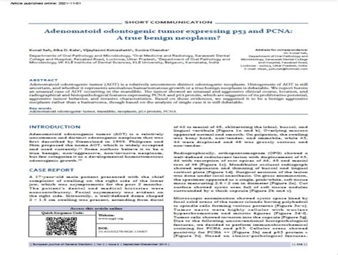 Adenomatoid odontogenic tumor expressing p53 and PCNA: A true benign ...