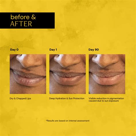 Buy Brightening Lip Balm Online With SPF Pack of 2 at Deconstruct