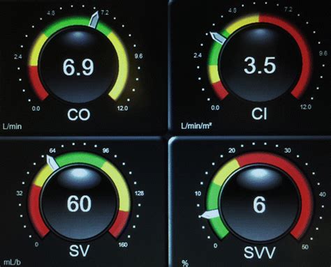 Image result for Testing Cardiac Monitor Output
