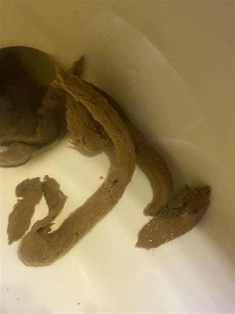 Thin Stools Bowel Movements