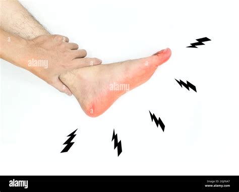 Tingling and burning sensation in foot of Asian young man with diabetes. Sensory neuropathy ...