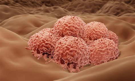 Image result for Cancer Detection Using Graph CNN