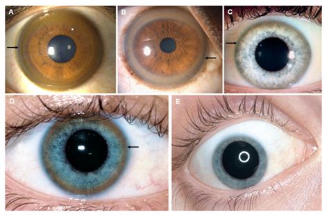 Image result for Iris Recognition Using MATLAB Source Code