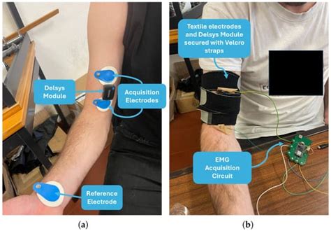 Integrating sEMG and IMU Sensors in an e-Textile Smart Vest for Forward ...