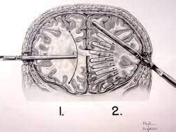 Image result for Playwright Test Code Example