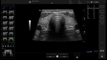 Versana Premier | GE Healthcare