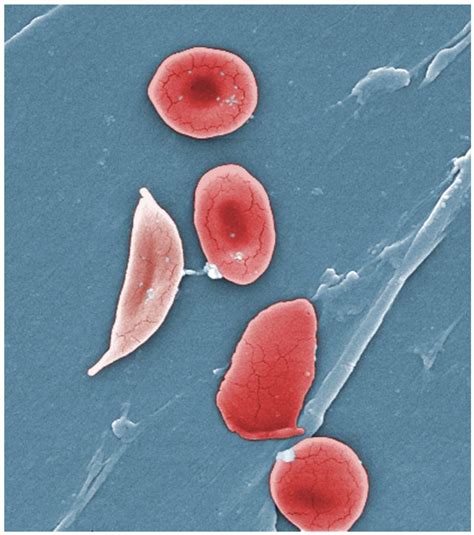 Erythrocytes · Anatomy and Physiology