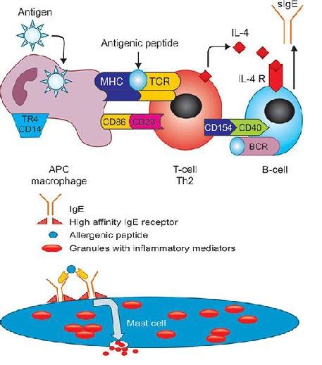 Allergic Rhinitis: A Critical Modern Review | International Journal of ...
