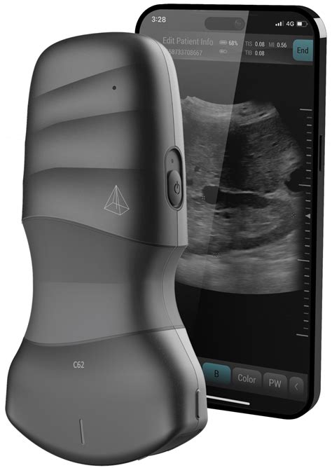 Neo C62 Wireless Handheld Ultrasound System – Neo Medical USA Inc