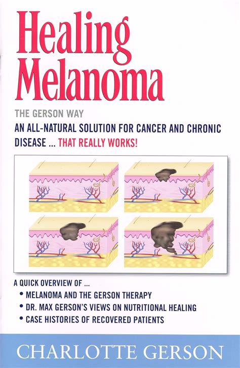 Buy Healing Melanoma - The Gerson Way Book Online at Low Prices in ...