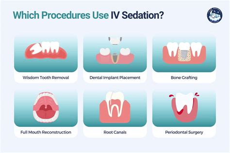 IV Sedation Dentistry Brisbane - Intravenous Sedation Dentist