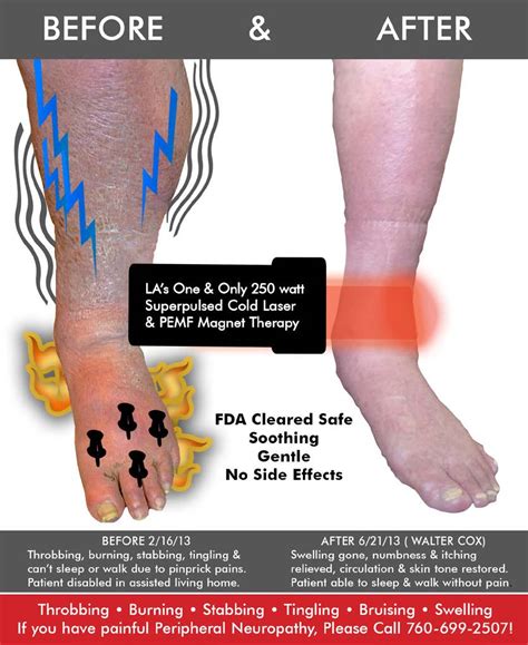 Relieve the Pain & Numbness in Your Feet, Knees & Legs – Dr. Phillip Yoo