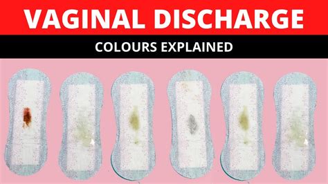 Vaginal Discharge Colours | Is My Discharge Normal:Thrush, Bacterial ...