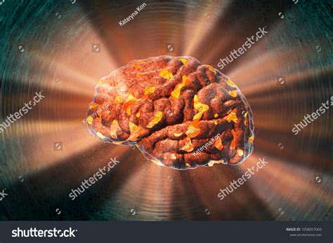 Image result for Brain Decimation