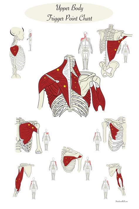 Upper Body - Trigger Point Chart - Muscle Anatomy Art - Chiropractic - Massage Therapist ...