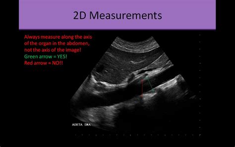 How To Read Ultrasound Of Abdomen at Holly Brough blog
