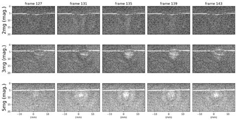 Ultrasound B-Mode Visualization of Imperceptible Subwavelength ...