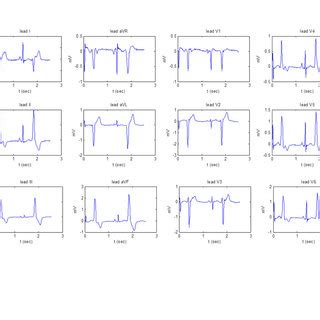 Image result for PVC Localization
