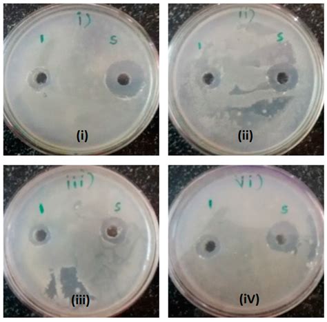 Screening, Purification and Characterization of Anionic Antimicrobial ...