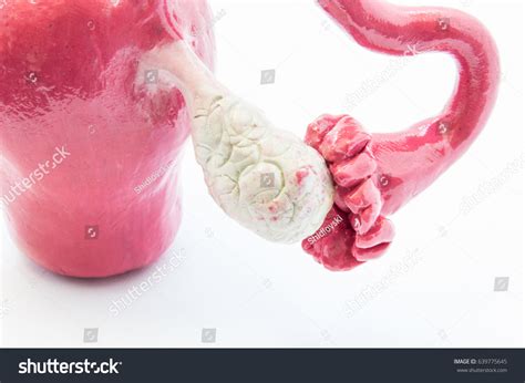 Anatomical 3d Model Ovaries Fallopian Tube Stock Photo 639775645 ...